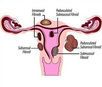 abs-gyn-07
